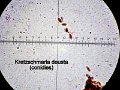 Kretzschmaria deusta-amf1917-conidies